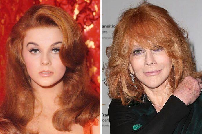 Ann Margret: Before and After Plastic Surgery