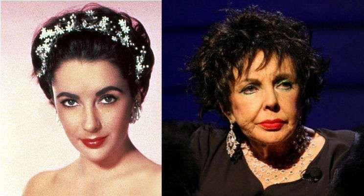 Celebrities Who Have Aged the Worst